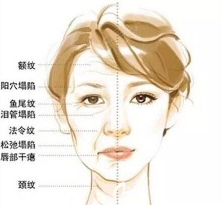 线雕的优势及维持时间