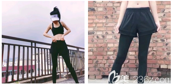 东莞抽脂减肥哪家医院好 东莞抽脂减肥哪家医院好