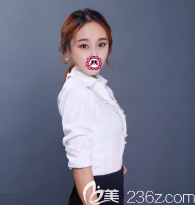 北京艺美整形埋线双眼皮案例