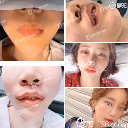 韩国女神嘴角上扬 韩国女神嘴角上扬