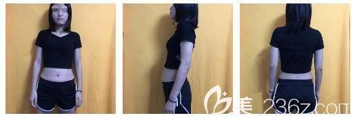 面诊南通俪人连天美术前腰腹部肥胖 面诊南通俪人连天美术前腰腹部肥胖