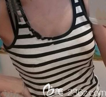 呼和浩特张高贵医疗美容门诊部张高贵术前照片1