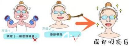 面部吸脂前需要做哪些准备工作