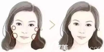 做面部吸脂前需要做六项准备工作