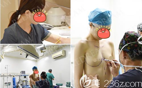 杭州薇琳做假体隆胸过程