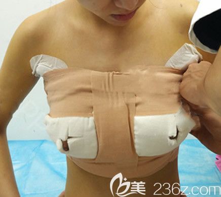 华美王金红假体隆胸术后即刻效果 华美王金红假体隆胸术后即刻效果