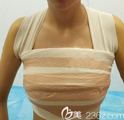 曼托假体隆胸第二天效果 曼托假体隆胸第二天效果