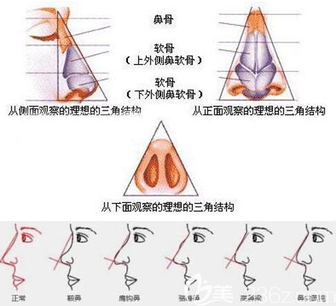 韩国Glory整形根据不同鼻型打造精致鼻尖 韩国Glory整形根据不同鼻型打造精致鼻尖