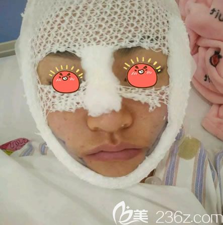 永康光大持久V脸术即刻效果 永康光大持久V脸术即刻效果