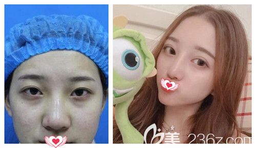 石家庄天伊美五月小长假含2980元双眼皮的美丽大礼包来袭 请注意查收