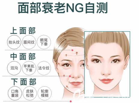 面部下垂自测图