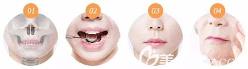 韩国MVP人中缩短术