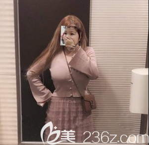 腰腹吸脂术后又做了面部吸脂+手臂吸脂 腰腹吸脂术后又做了面部吸脂+手臂吸脂