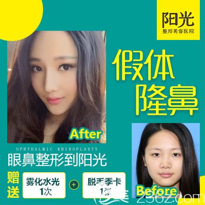 整形医院陈群院长隆鼻案例 整形医院陈群院长隆鼻案例