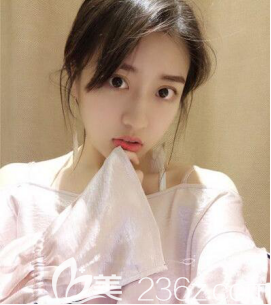 于建涛瘦脸和假体垫下巴术后2个月 于建涛瘦脸和假体垫下巴术后2个月