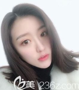 必须得说我被遵义韩美做的这个瘦脸+假体垫下巴后的我迷住了。