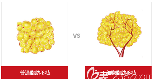 韩国cellpia整形医院治疗