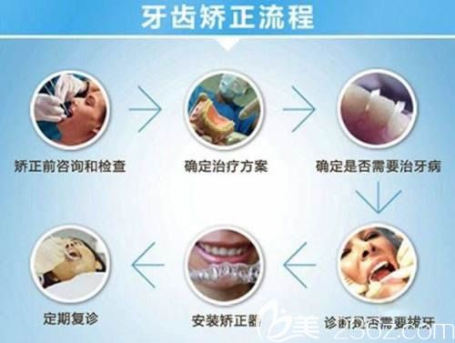 北京牙管家口腔正畸流程 北京牙管家口腔正畸流程