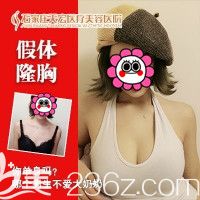 石家庄天宏做假体隆胸案例 石家庄天宏做假体隆胸案例