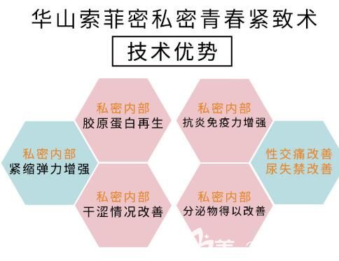 郑州医德佳埋线缩阴技术优势
