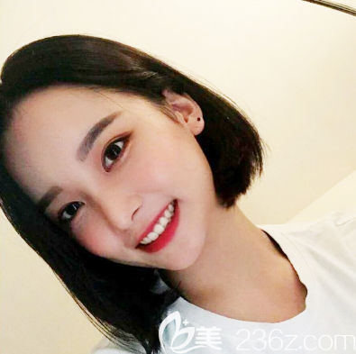 感谢广州紫馨曹仁昌院长帮我修复好了眼睛 感谢广州紫馨曹仁昌院长帮我修复好了眼睛