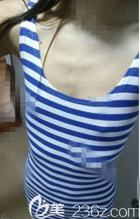 韩国玛博尔整形外科做胸怎么样 韩国玛博尔整形外科做胸怎么样