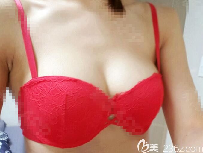 <!--<i data=20240703-sp></i>-->范隆胸怎么样 <!--<i data=20240703-sp></i>-->范隆胸怎么样