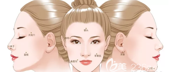 面部自体脂肪移植的部位 面部自体脂肪移植的部位