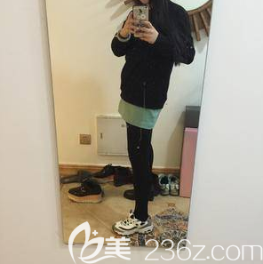 在北京米兰柏羽丽都注射瘦腿第14天效果 在北京米兰柏羽丽都注射瘦腿第14天效果