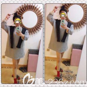 北京米兰柏羽丽都医院注射瘦腿案例 北京米兰柏羽丽都医院注射瘦腿案例