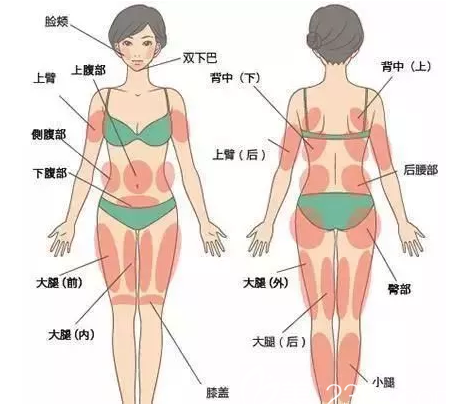 吸脂手术适合部位 吸脂手术适合部位