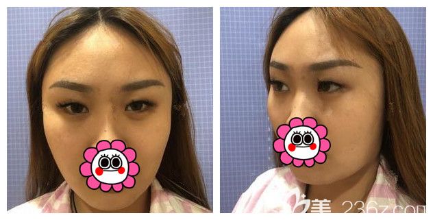 面诊苏州康美医生术前 面诊苏州康美医生术前