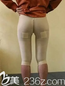 大腿吸脂术中的样子 大腿吸脂术中的样子