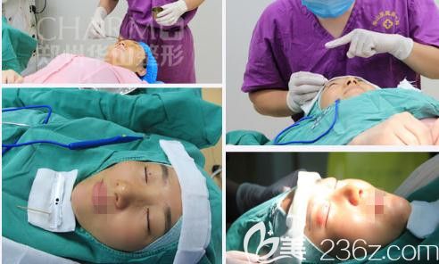 阿尔法美眼术手术进行时