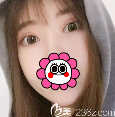 北京壹加壹眼综合案例 北京壹加壹眼综合案例