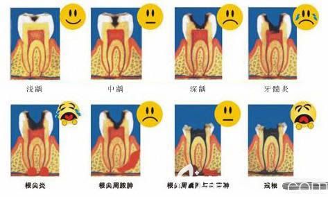 牙体牙髓病的发展过程图解