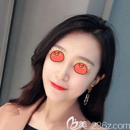 绍兴上虞艺美隆鼻<span style= 绍兴上虞艺美隆鼻<span style=