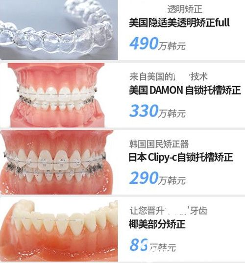 韩国首尔椰美牙科牙齿矫正 韩国首尔椰美牙科牙齿矫正