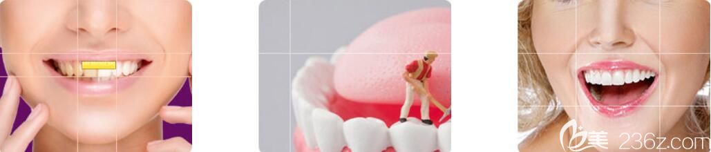 <!--<i data=20240703-sp></i>-->牙齿修复技术特点 <!--<i data=20240703-sp></i>-->牙齿修复技术特点