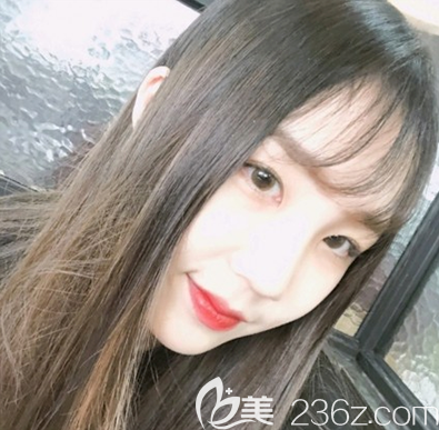 韩式双眼皮类型那么多别再追求双眼皮6 7 8毫米效果了，在韩国乐于丽颜整形做的眼综合就很适合自己