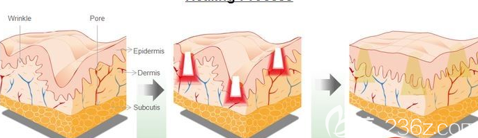 20190510_1557469505365539.png image.png