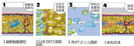 20190510_1557473662355125.png image.png