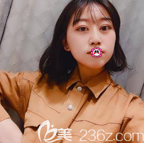北京美莱膨体隆鼻和双眼皮 北京美莱膨体隆鼻和双眼皮