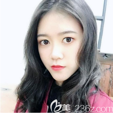 东莞美立方李志刚做脂肪填充怎么样 东莞美立方李志刚做脂肪填充怎么样