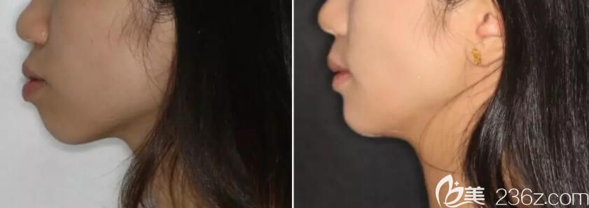 中山好民生口腔何为医生的水平怎么样 中山好民生口腔何为医生的水平怎么样