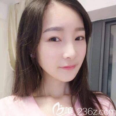 韩国佳轮韩整形医院轮廓三件套:下颌角+下巴+颧骨整形手术案例 韩国佳轮韩整形医院轮廓三件套:下颌角+下巴+颧骨整形手术案例