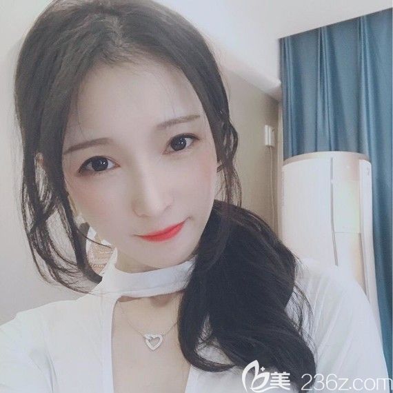 考虑韩国下颌角整形手术价格与效果成正比,看下我选韩国佳轮韩做的V-LINE瓜子脸好吗