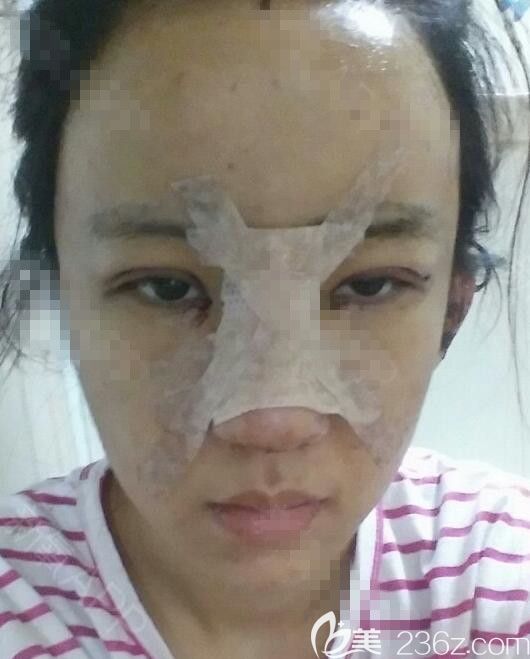 手术当天 手术当天