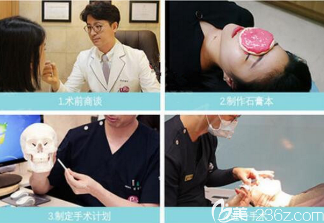 韩国POP整形医院鼻部石膏模型制作 韩国POP整形医院鼻部石膏模型制作