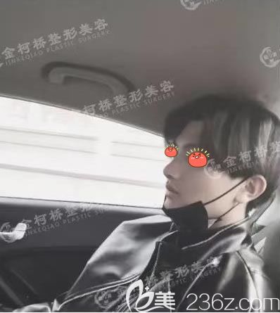 医院陈树科做假体耳软骨隆鼻鼻子整形手术案例,记录一下恢复的过程